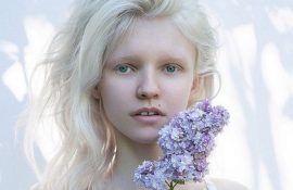 дети альбиносы