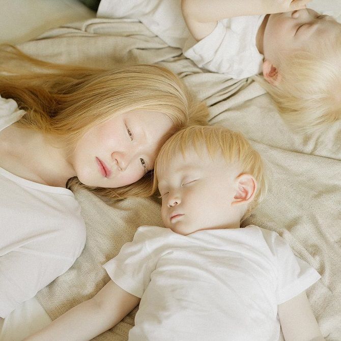 дети альбиносы