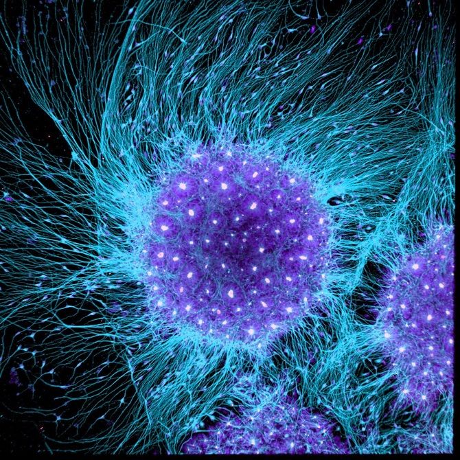 Клітини людського мозку под микроскопом