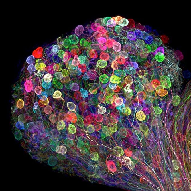 Нервы в человеческом глазу под микроскопом