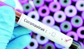 Симптоми коронавірусу: як розпізнати хворобу