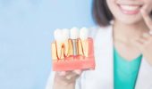 Показания к проведению костной пластики, возможные альтернативы при имплантации зубов