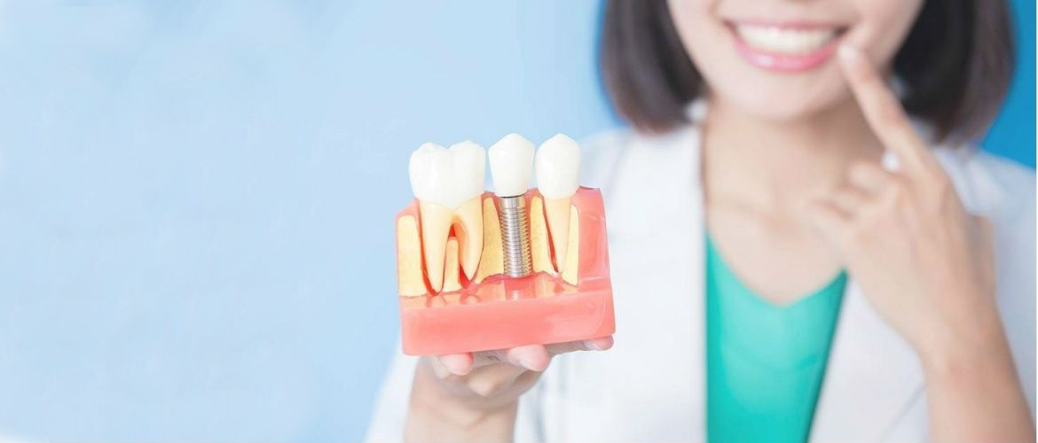 Показания к проведению костной пластики, возможные альтернативы при имплантации зубов