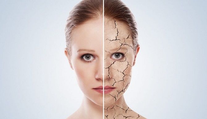 Зневоднена шкіра: ознаки і правила догляду за нею 1