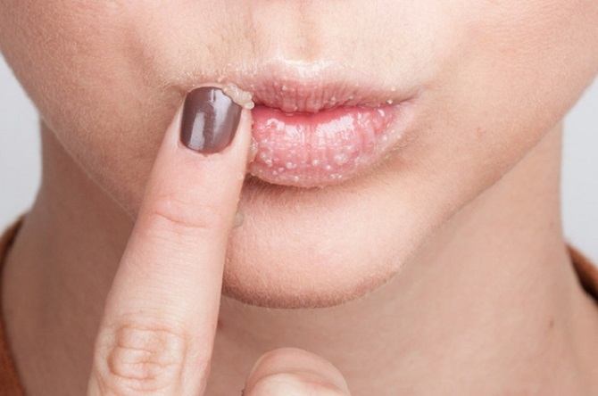 Ухаживаем за губами: зачем им нужен пилинг, крутые рецепты скрабов для губ своими руками 1