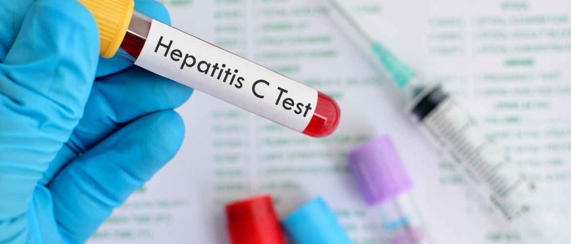 Тестирование на гепатит С: почему это важно?