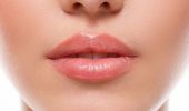 Контурная пластика губ с гиалуроновой кислотой: как безопасно увеличить губки и придать им красоту
