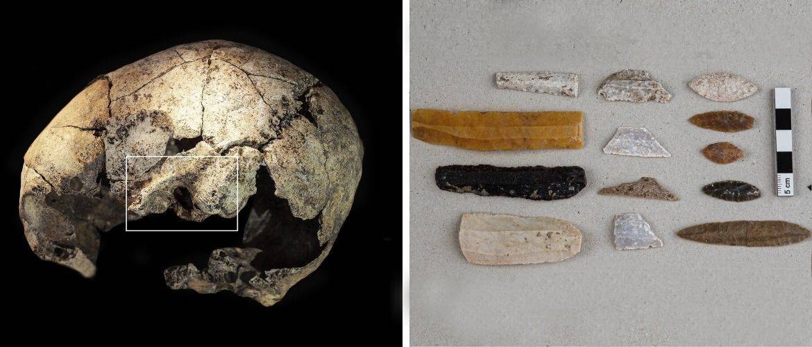 На черепе возрастом 5300 лет обнаружены следы древнейшей хирургической операции на ухе