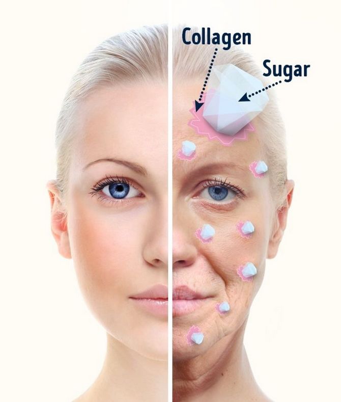 3 негативных последствия чрезмерного потребления сахара для здоровья кожи 1