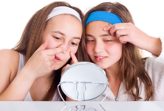 Hautpflege für Teenager: 4 einfache Schritte 2