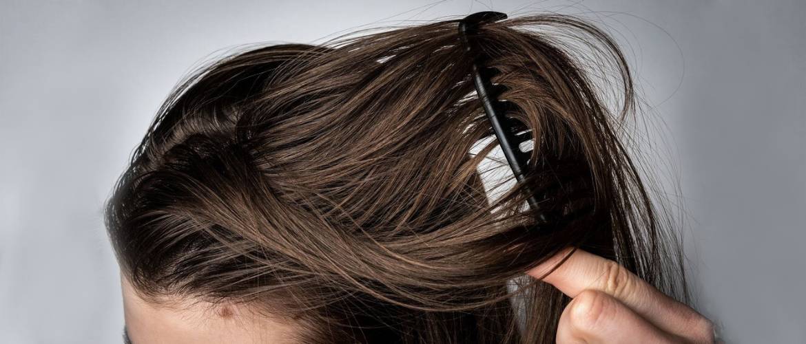 Oily hair quickly: tips on how to deal with the problem