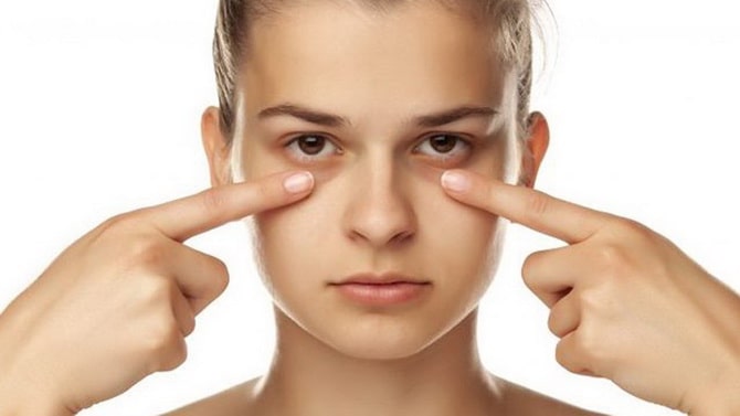 Quick Ways to Get Rid of Puffy Eyes in the Morning 4
