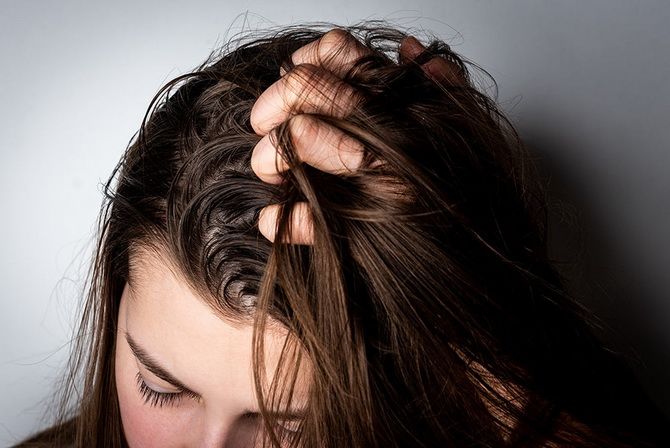 Oily hair quickly: tips on how to deal with the problem 1