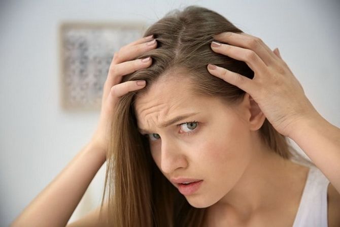 Hair loss in women: the most common causes and solutions 2