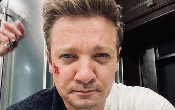 Marvel movie star Jeremy Renner may have leg amputated 3