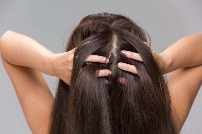 Як відновити волосся після стресу 2