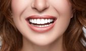 Имплантация зубов: что нужно знать, если вы решили установить импланты