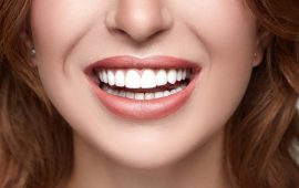 Имплантация зубов: что нужно знать, если вы решили установить импланты