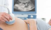 Як не пропустити скринінг: коли робиться УЗД під час вагітності?