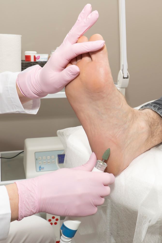 Апаратний педикюр – якісний догляд за ногами 2