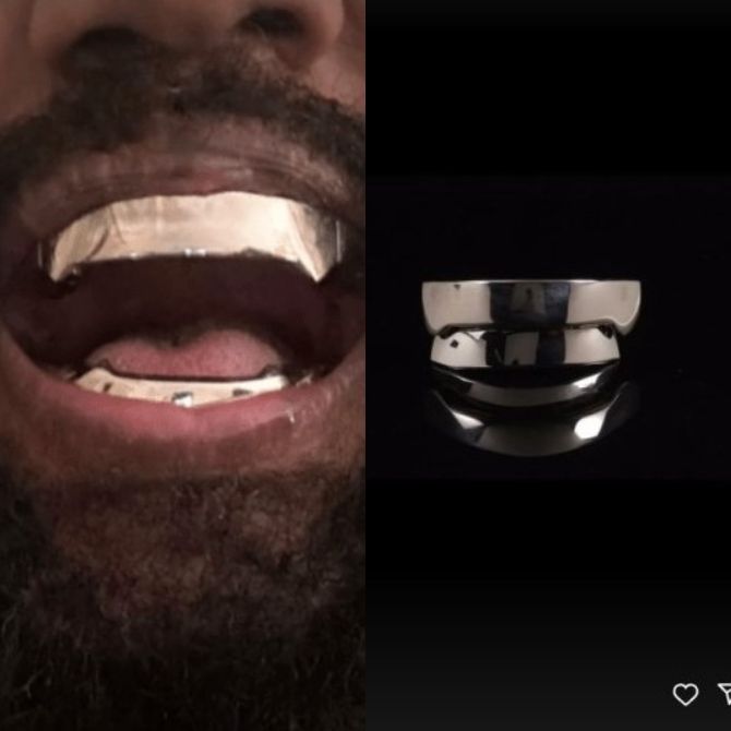 Kanye West had his teeth removed and replaced with titanium dentures 1