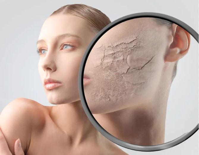 Догляд за зневодненою шкірою: методи швидкого та ефективного зволоження 2