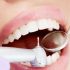 Эстетическая стоматология в Грузии – как вернуть здоровую и красивую улыбку