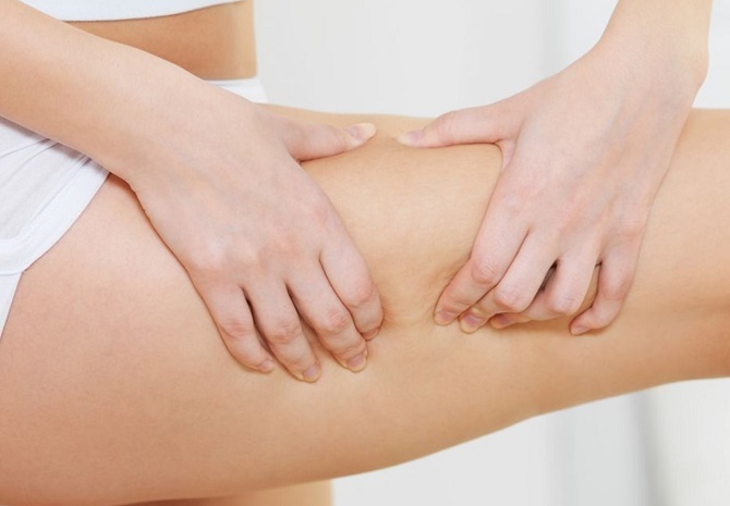 5 practical tips on how to get rid of cellulite at home 1