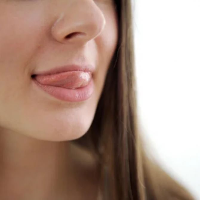 So vermeiden Sie rissige Lippen: Ursachen und Behandlung 5