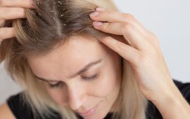 How to get rid of dandruff at home