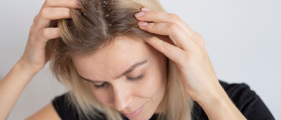 How to get rid of dandruff at home