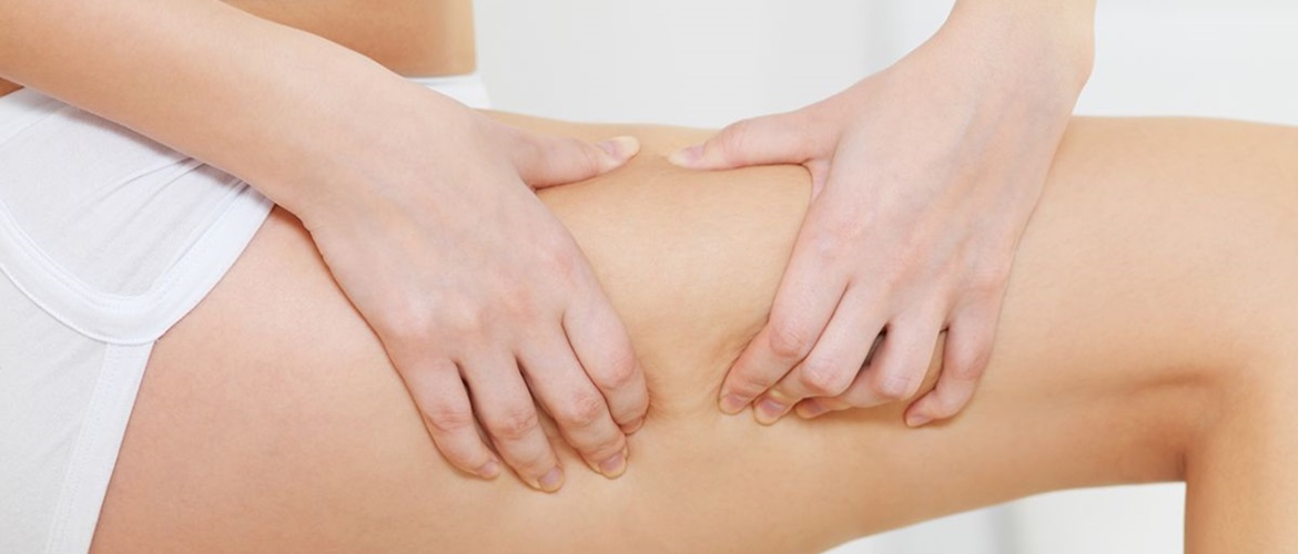 Anti-Cellulite-Creme für zu Hause: Wie man sie herstellt und welche Eigenschaften sie hat