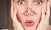 How to get rid of blackheads on the face at home