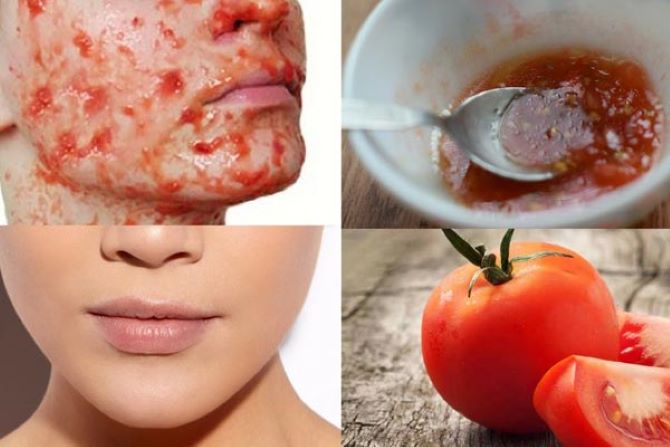 Tomaten-Gesichtsmaske – Rezepte für makellose Haut 3