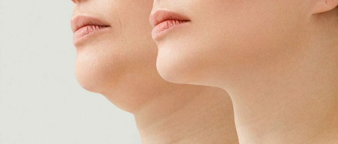 How to remove a double chin: 7 effective exercises