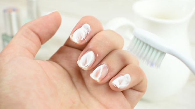 How to whiten nails at home: 5 simple ways 2