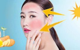 How to Get Rid of Sunburn at Home: 5 Ways