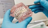 Корректируем детский прикус: со скольких лет можно и какой способ выбрать