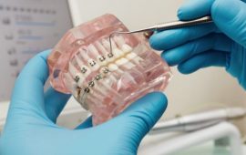 Корректируем детский прикус: со скольких лет можно и какой способ выбрать