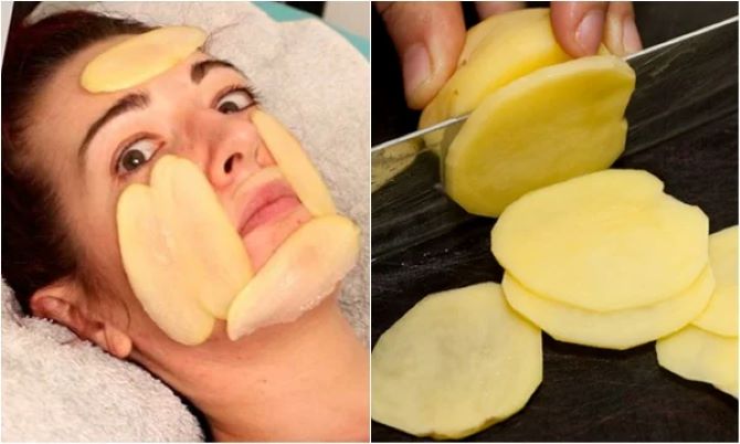How to Get Rid of Sunburn at Home: 5 Ways 1
