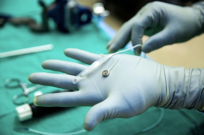 Neuralink Competitor Installs First Human Brain Chip 1