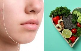 Akne-Diät: Was Sie essen sollten, um hormonelle Akne loszuwerden