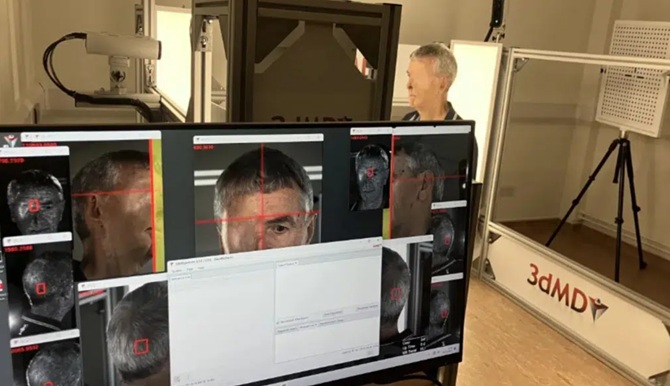 Британець першим у світі отримав лицьовий протез, надрукований на 3D-принтері 2