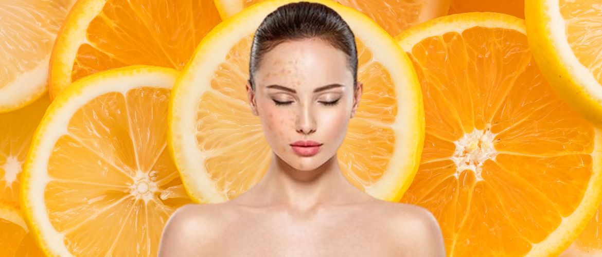 4 Fruits That Help Reduce Skin Pigmentation