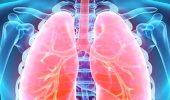 Wissenschaftler transplantieren Lungen von einem Schwein auf einen Menschen