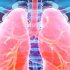 Wissenschaftler transplantieren Lungen von einem Schwein auf einen Menschen