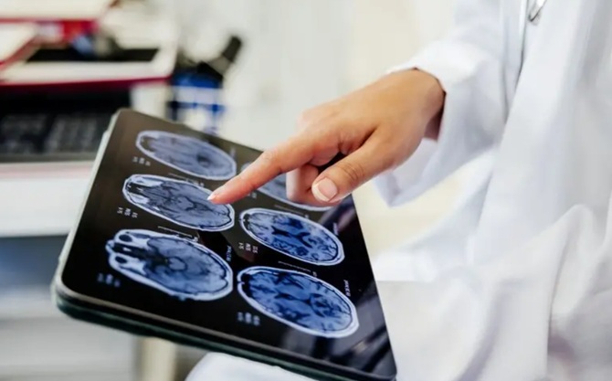 Amerikanische Wissenschaftler haben ein Gehirnimplantat entwickelt, das Gedanken liest 1