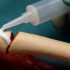 A glue has been created that instantly fuses broken human bones