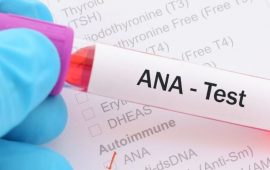 Тест ANA (антинуклеарные антитела): когда и кому назначают анализ, интерпретация результатов