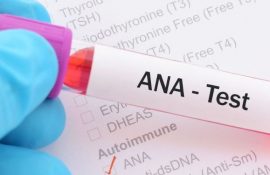 Тест ANA (антинуклеарные антитела): когда и кому назначают анализ, интерпретация результатов